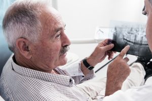 Man Reviewing Dental X-rays