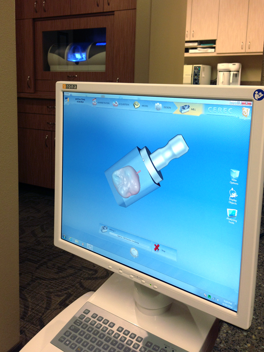 CEREC machine screen
