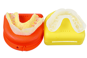 Dental Mouthguards